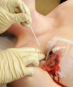TyTek Medical TPAK neula